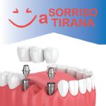 SORRISO A TIRANA SORRISO A TIRANA